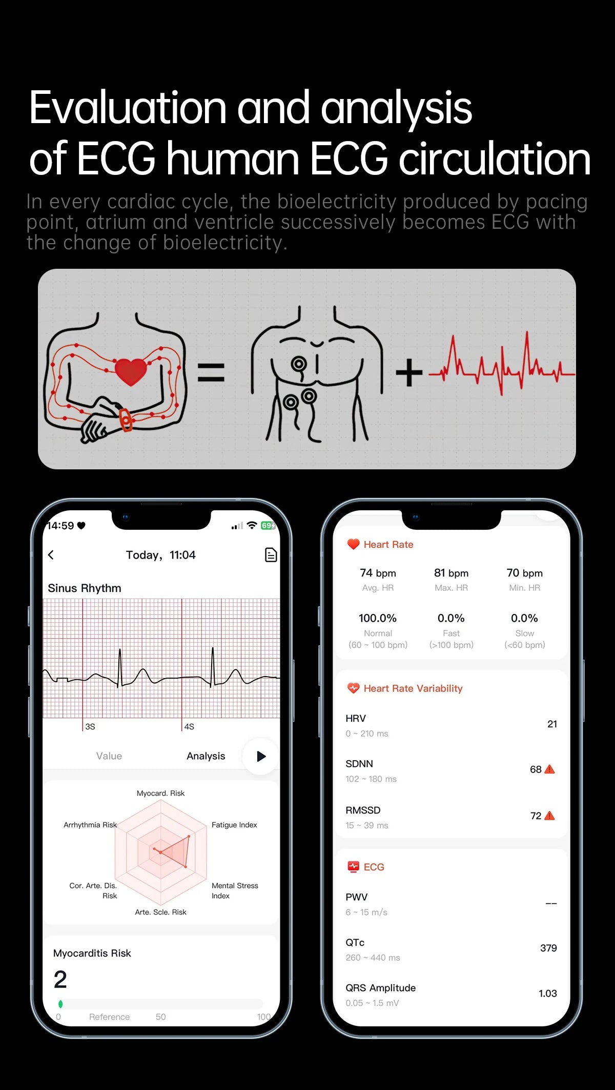 HUAWEI Smart Health Watch 2025 - ECG+PPG Blood Pressure Monitor with NFC & HD Calling